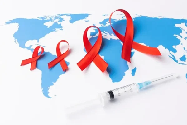 hiv aids