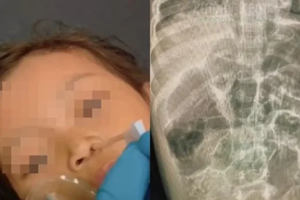 Balita Meninggal di Sukabumi, Kemenkes Beri Peringatan Penting Balita Meninggal di Sukabumi, Kemenkes Beri Peringatan Penting | infeksi cacingan