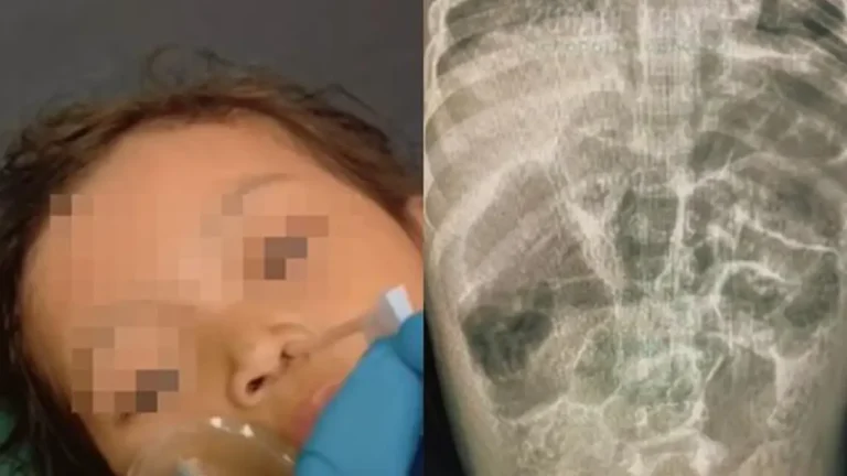 Balita Meninggal di Sukabumi, Kemenkes Beri Peringatan Penting